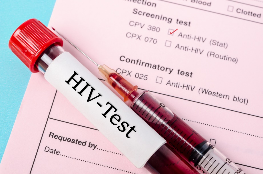 Diagnostisk test for tilstedeværelse av anti-HIV-antistoffer i en blodprøve fra en pasient.