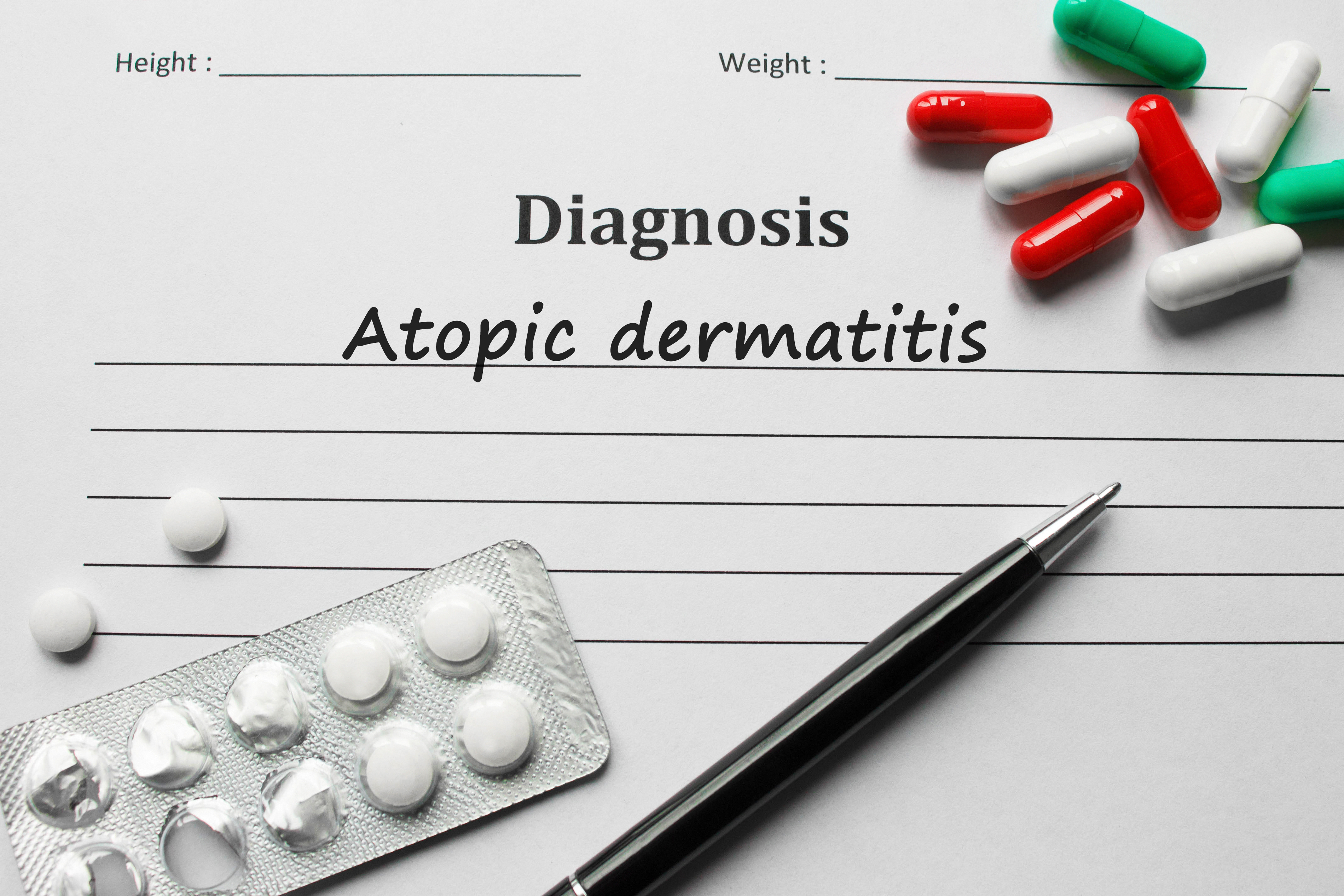 Diagnostisering av atopisk dermatitt