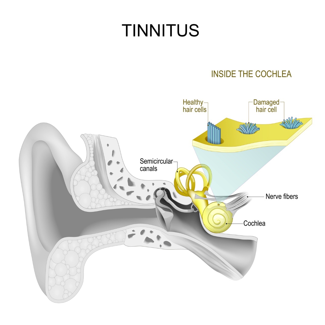 Indre øre og tinnitus - plystring og summing i øret