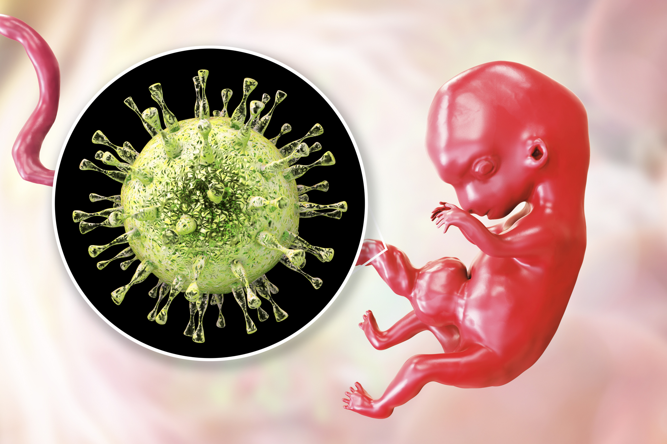 Transplacental overføring av cytomegalovirus