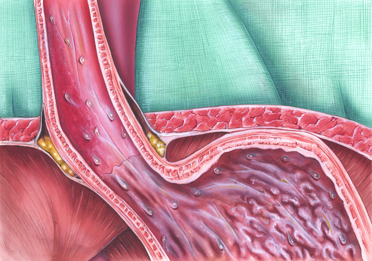 anatomisk avbildet lukkemuskel på spiserøret