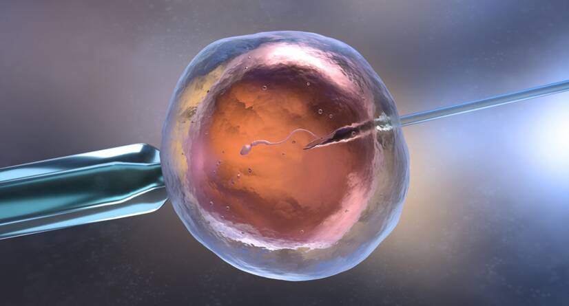 In vitro-fertilisering (IVF) Kilde: Getty Images