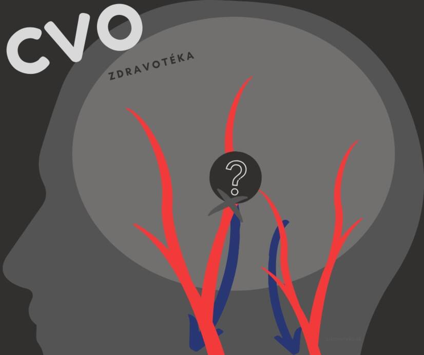 Cerebrovaskulær sykdom: svekkede, innsnevrede eller utvidede blodårer i hjernen? Kjenn årsakene og symptomene