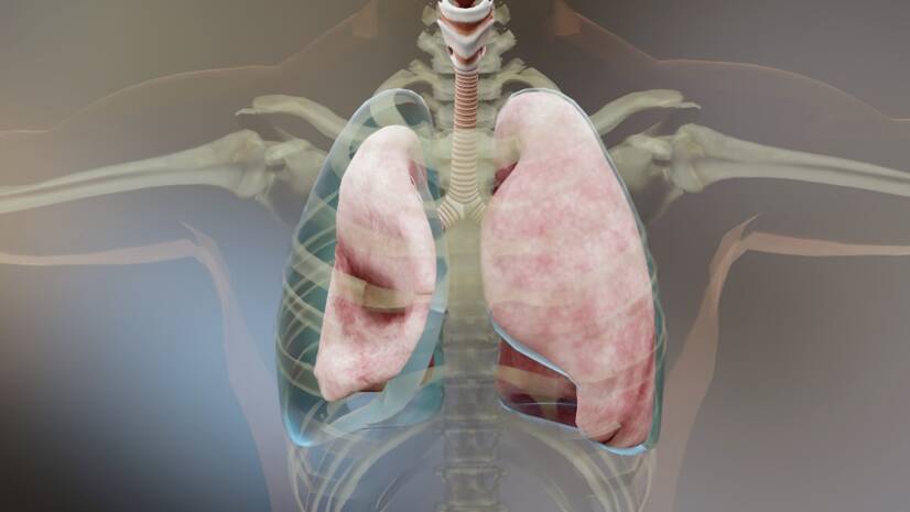 Pneumothorax (luft i brystet): årsaker, symptomer og førstehjelp