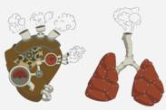 Pulmonal hypertensjon: hva er det og hvorfor oppstår det? + Symptomer og behandling